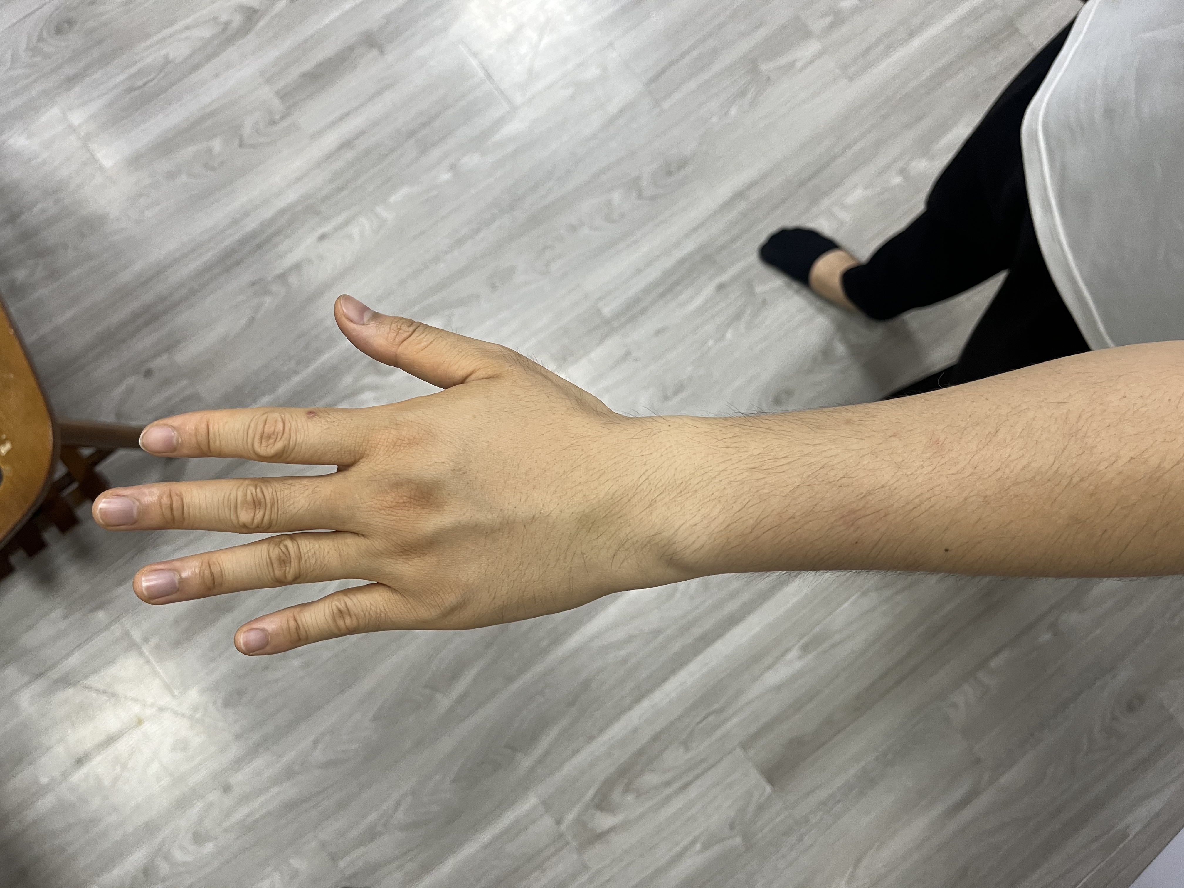 Bàn tay duỗi thẳng mẫu 2