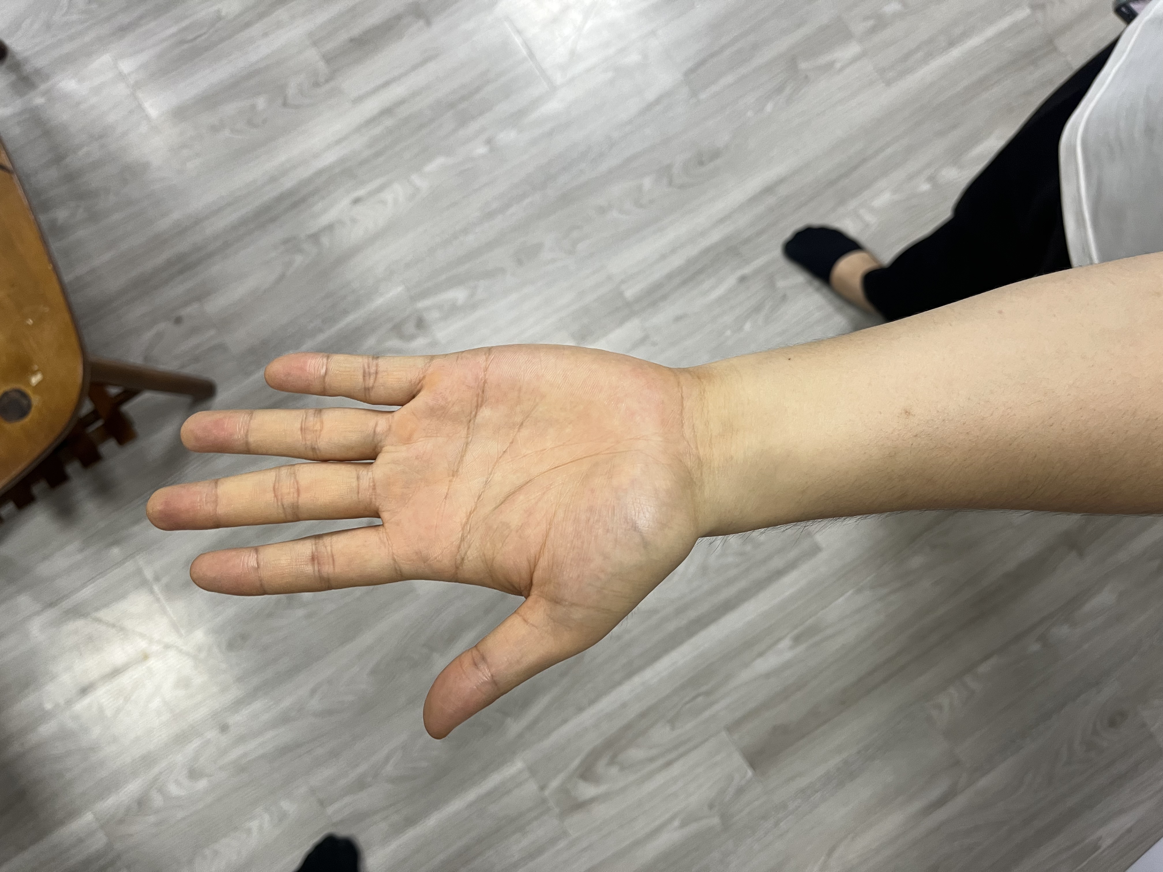 Bàn tay duỗi thẳng mẫu 3
